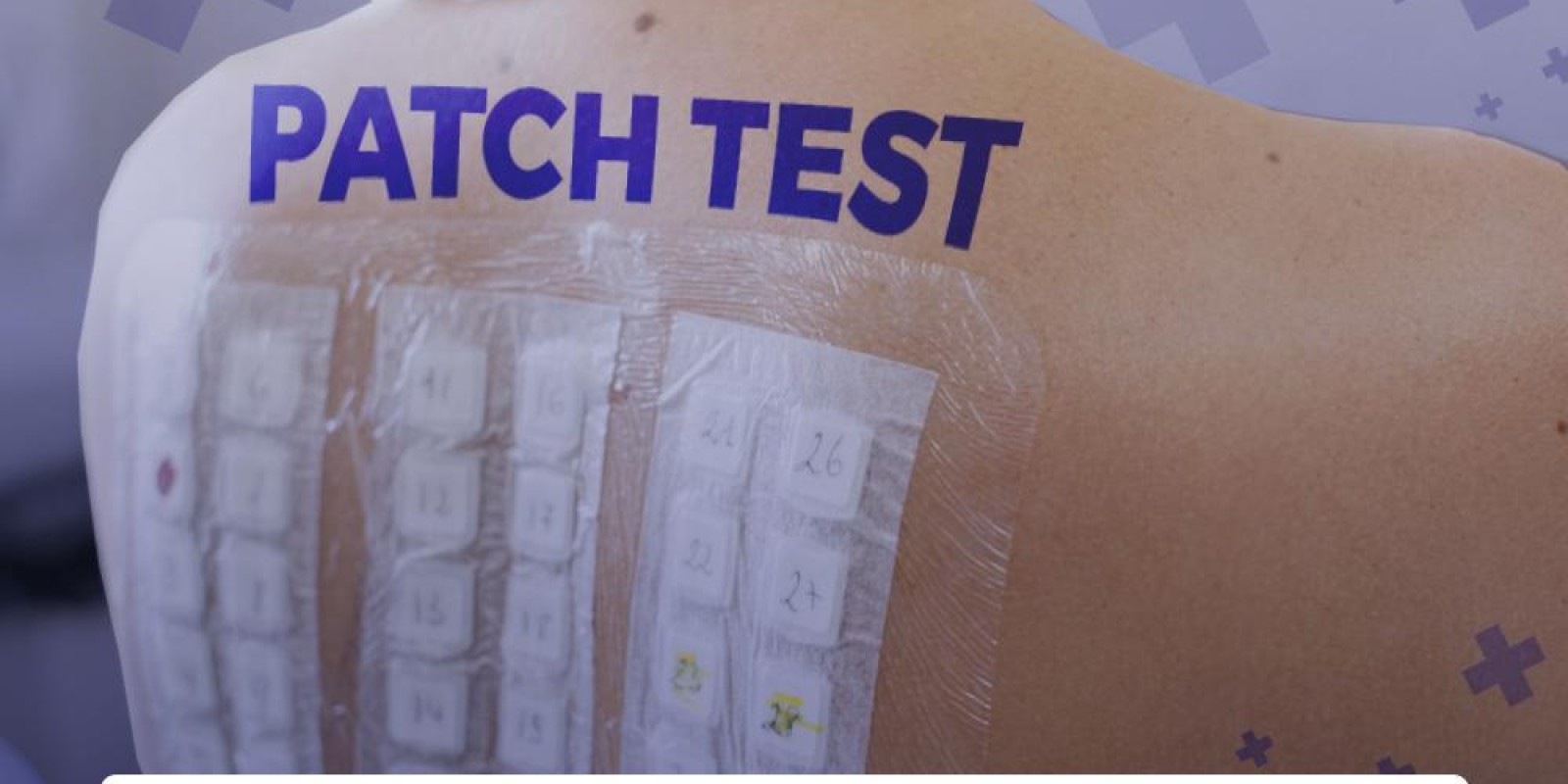 Patch Test